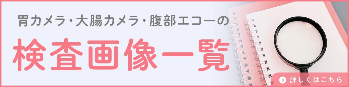 胃カメラ・大腸カメラ・腹部エコーの検査画像一覧